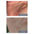Load image into Gallery viewer, SCAR KIT FOR BODY