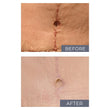 Load image into Gallery viewer, SCAR KIT FOR BODY