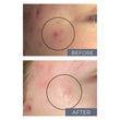 Load image into Gallery viewer, SCAR KIT FOR FACE