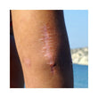 Load image into Gallery viewer, SCAR KIT FOR BODY